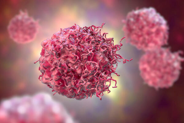 Bild vergrößern: Krebszellen